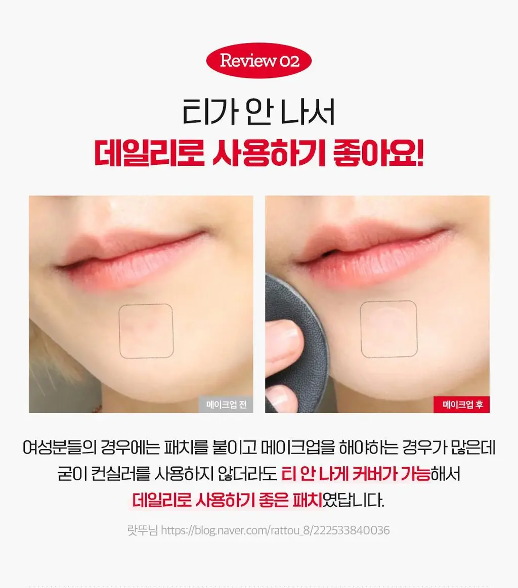 [피부고민케어]아리얼 트루 AC 스팟 패치 듀오 세트 106매 상세페이지 27